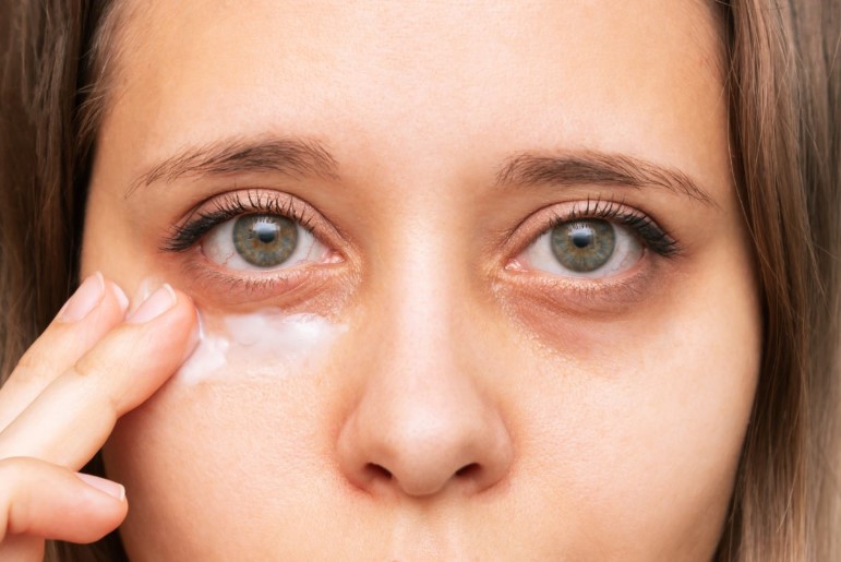 Eye Treatments for Puffy Eyes & Periorbital Hyperpigmentation – The ...